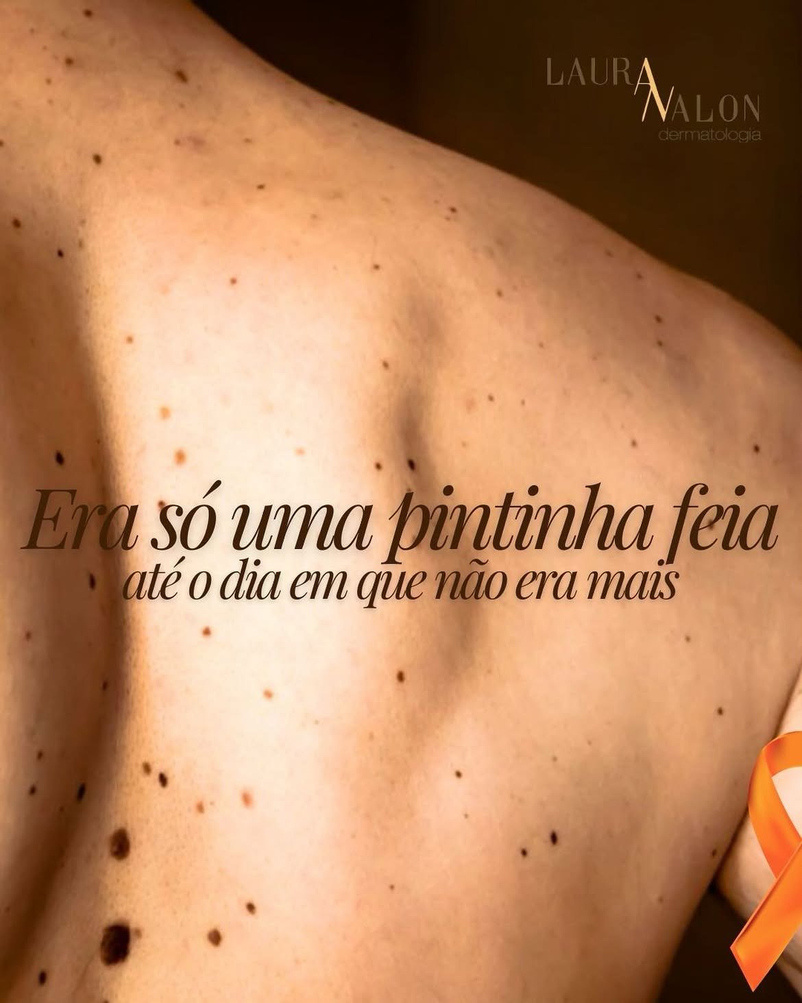 Costas com várias pintas e a frase: Era só uma pintinha feia até o dia em que não era mais